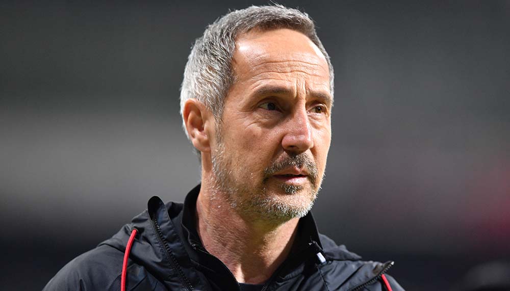 Eberl macht Hütter Druck: «Ablöse spielt für mich keine Rolle»