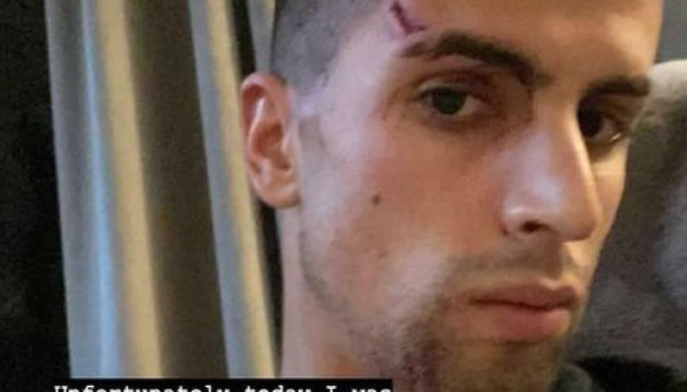 Einbrecher schlagen ManCity-Profi João Cancelo blutig