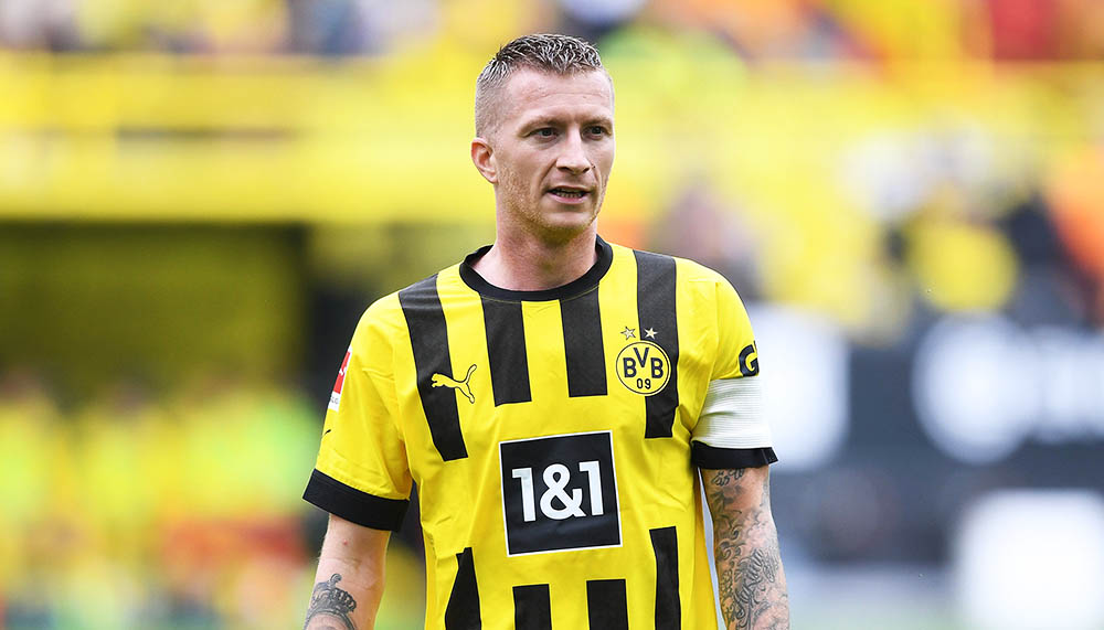 Kehl gibt Entwarnung bei Reus: «Untersuchungen haben keinen Bruch gezeigt»