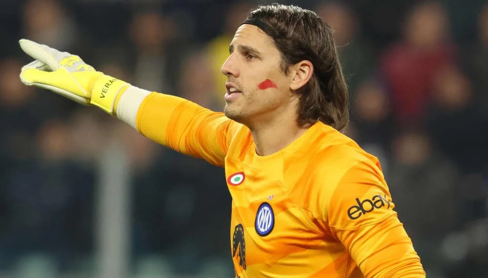 Yann Sommer spielt gegen Juve mit Farbe im Gesicht
