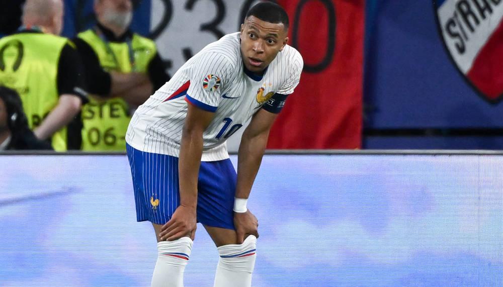 Kylian Mbappé muss die Nase operieren lassen