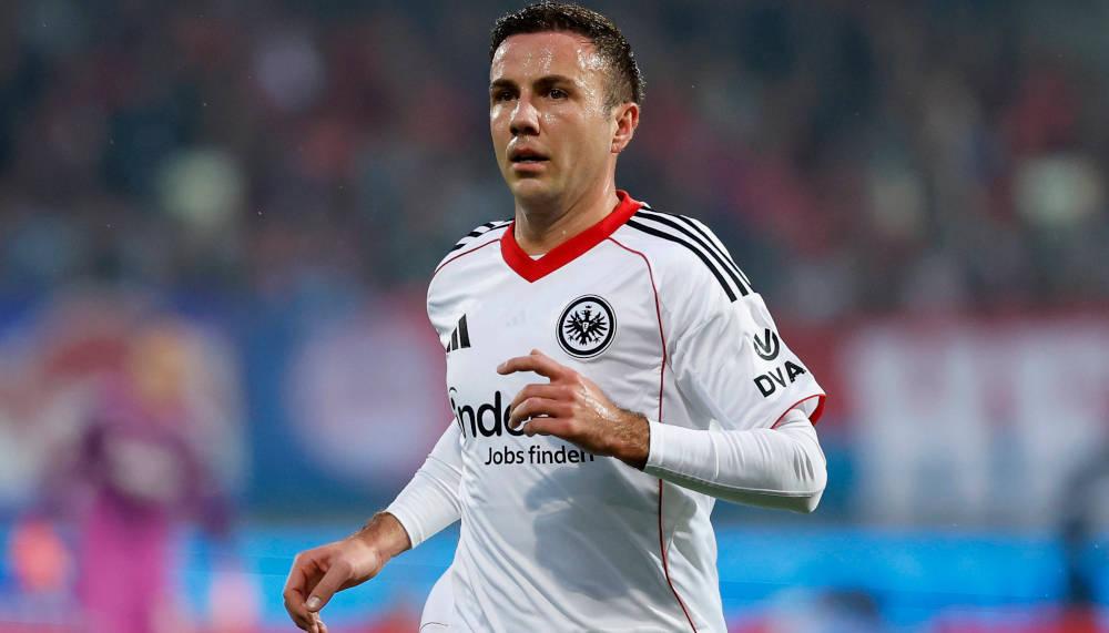 Mario Götze spricht über seine Haartransplantation